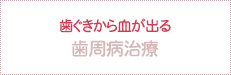 歯ぐきから血が出る 歯周病治療