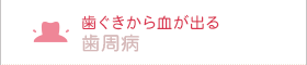 歯ぐきから血が出る 歯周病